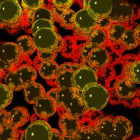 sports performance anxiety